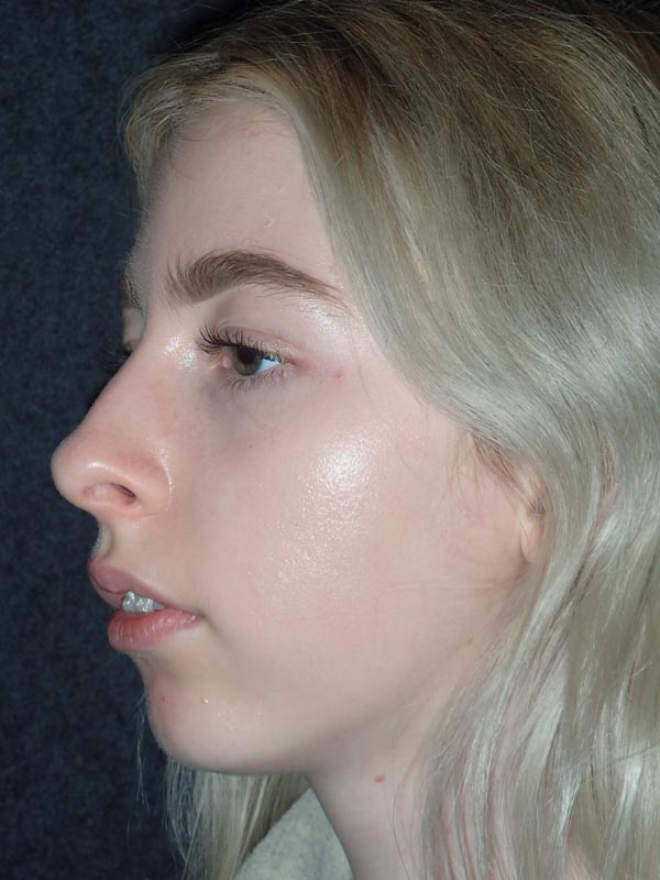 patient before Oral Surgery procedures