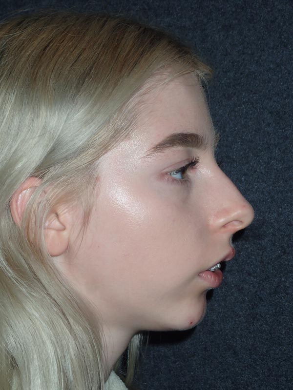 patient before Oral Surgery procedures