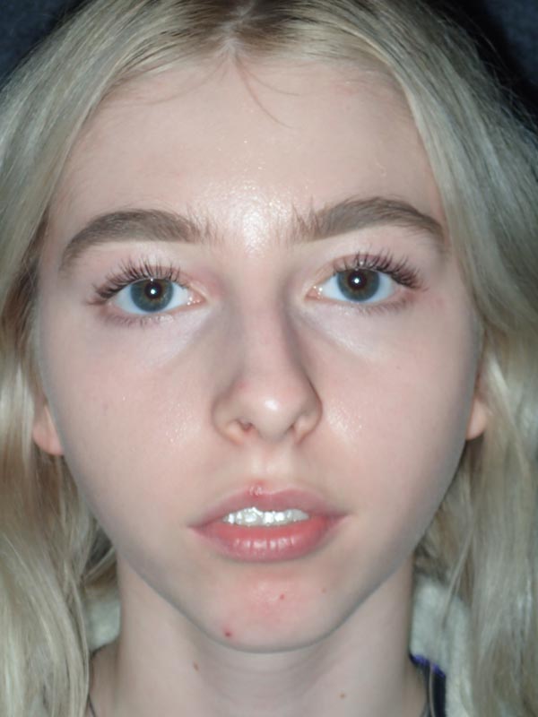 patient before Oral Surgery procedures