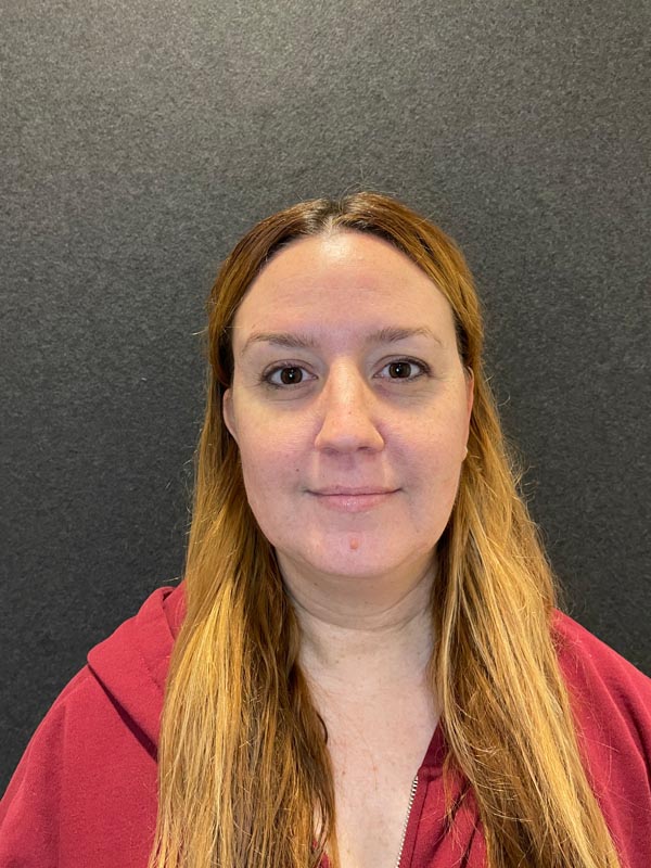 patient before Submental Liposuction & Chin Implant